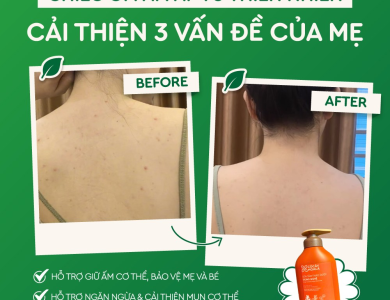Sữa Tắm Thảo Dược Gừng Nghệ - 500gr