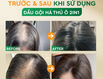 DẦU GỘI THẢO DƯỢC HÀ THỦ Ô 2in1